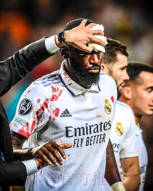 欧冠-吕迪格95分钟绝平+血染赛场!皇马1-1提前出线 欧冠-吕迪格95分钟绝平+血染赛场!皇马1-1提前出线